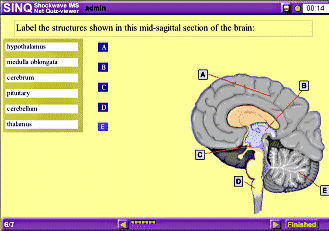 sinq quiz